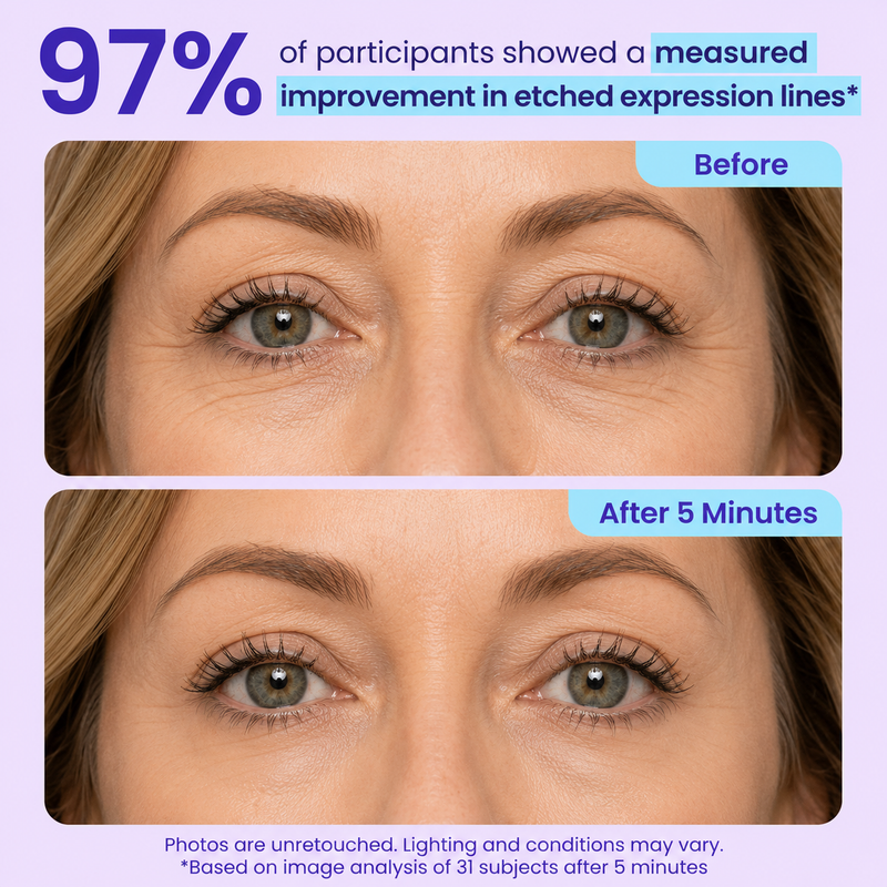 97% SOFTER CROW'S FEET