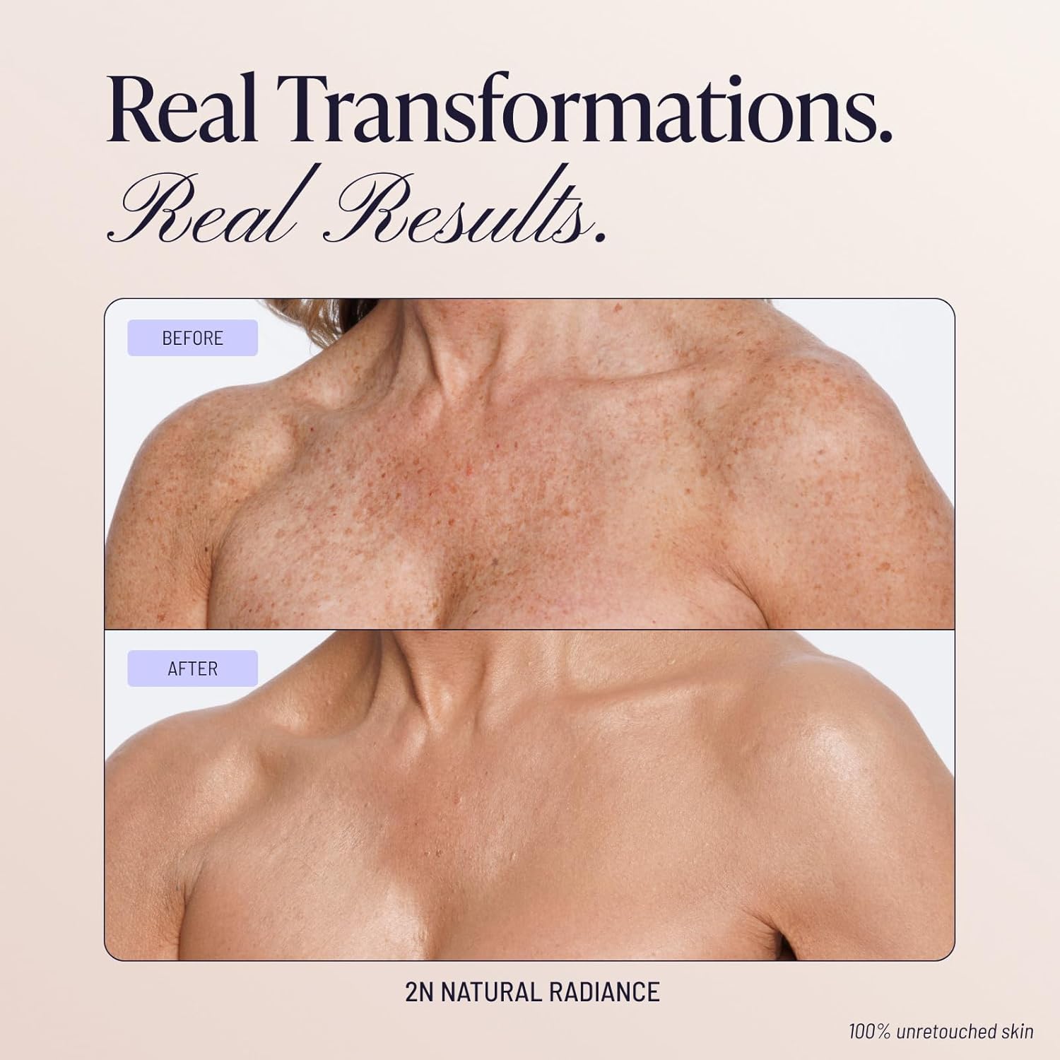 Real before-and-after